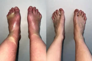 pes-e-tornozelos-saudaveis-após-usar-a-formula3