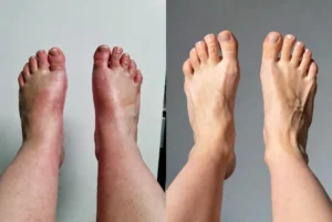 pes-e-tornozelos-saudaveis-após-usar-a-formula4